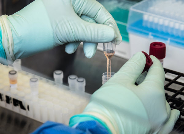 Hands of CDC scientist as they prepare to test a patient’s sample for SARS-CoV-2