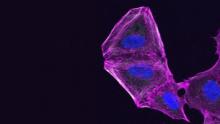 Ultraviolet slide of cancel cell