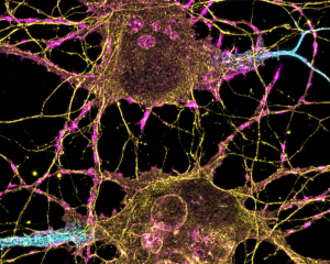NIH photo of neurons