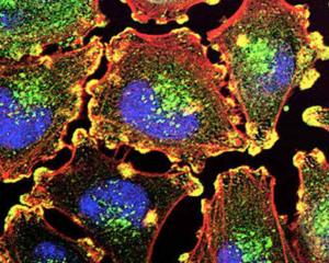 NIH close up photo of melonoma cells