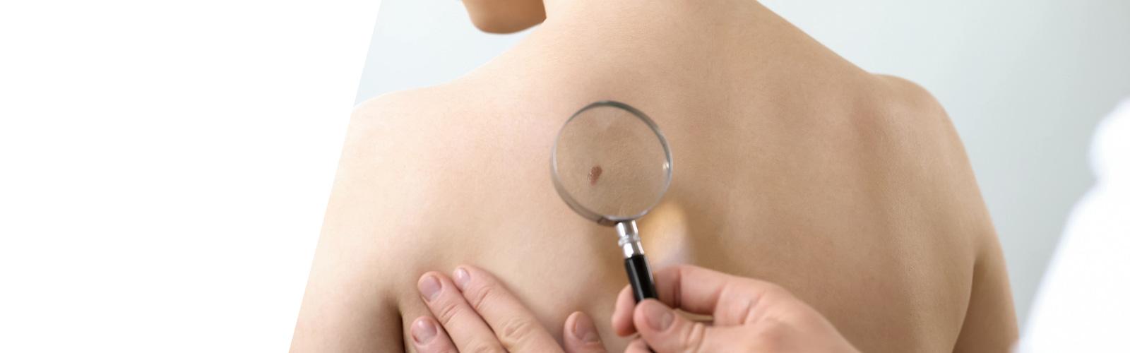 Examination of skin lesion on back of patient in a clinic setting