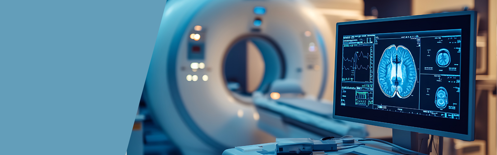 MRI machine in background with a computer screen showing a brain scan in the foreground
