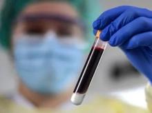 Masked researcher holding vial of blood - Britta Pedersen/dpa/picture alliance via Getty Images