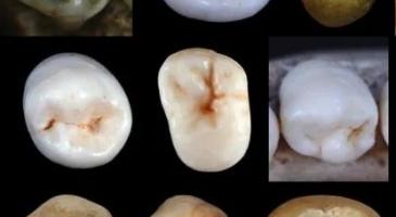 A collage of human teeth