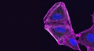 Ultraviolet slide of cancel cell