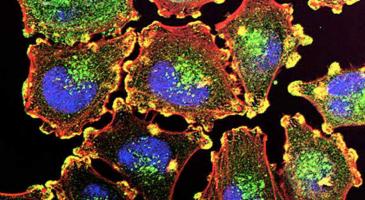 NIH close up photo of melonoma cells