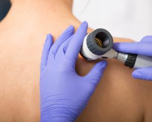 Practitioner examines skin on patient shoulder. Dermatopathologists told researchers that they see cases that should not have been biopsied in the first place, pointing to overdiagnosis as a problem that may be rooted in too many skin biopsies.Peakstock/Shutterstock