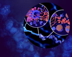 Microscopic photo of the pathological Tau protein showing disintegration of microstubili and aggregation to neurofibrillary tangles in a neuron axon.